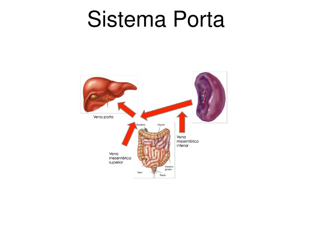 Hipertensión portal de la vena mesentérica inferior Hipertensión portal de la vena mesentérica inferior